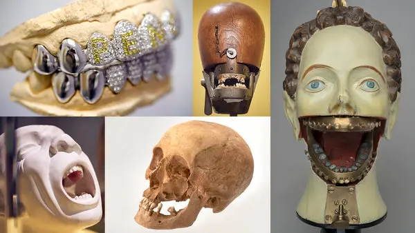 wellcome-collection-di-londra--teeth-mostra_london.webp